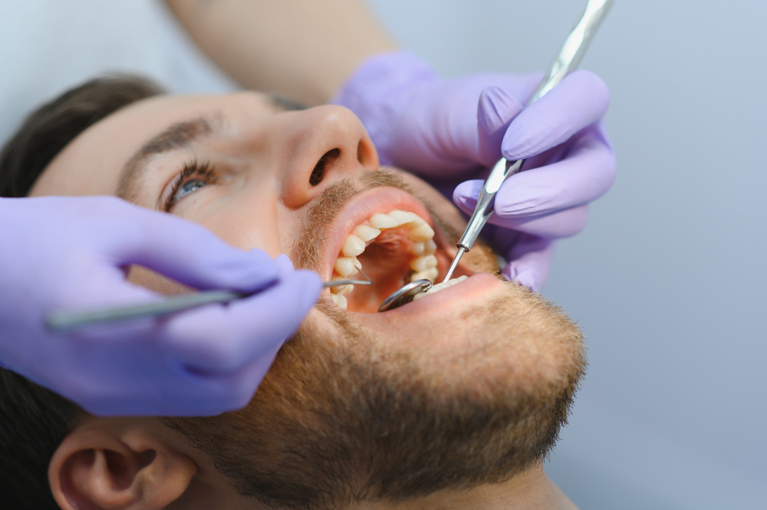 Addressing 5 Common Problems with All-on-4 Dental Implants