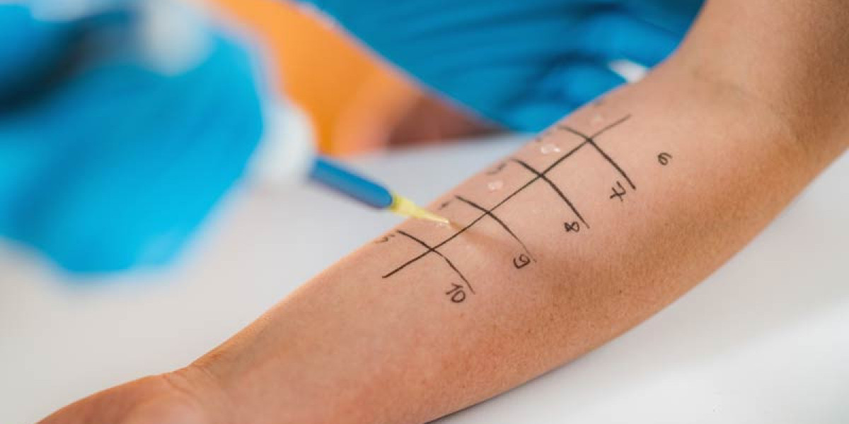 Allergy Testing: Find Your Triggers and Take Control of Your Health
