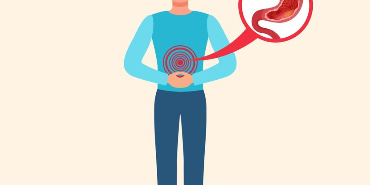 Comprensión Y Tratamiento Del Estreñimiento: Una Guía Para Médicos