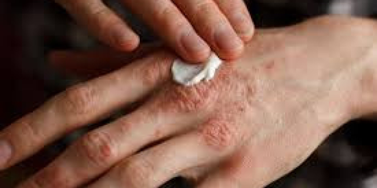 When Should You See an Allergist in Merced for Help?