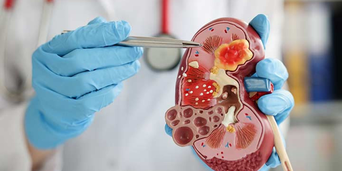 Discover the Best Nephrology Treatment in Sahibabad at V Care Hospital