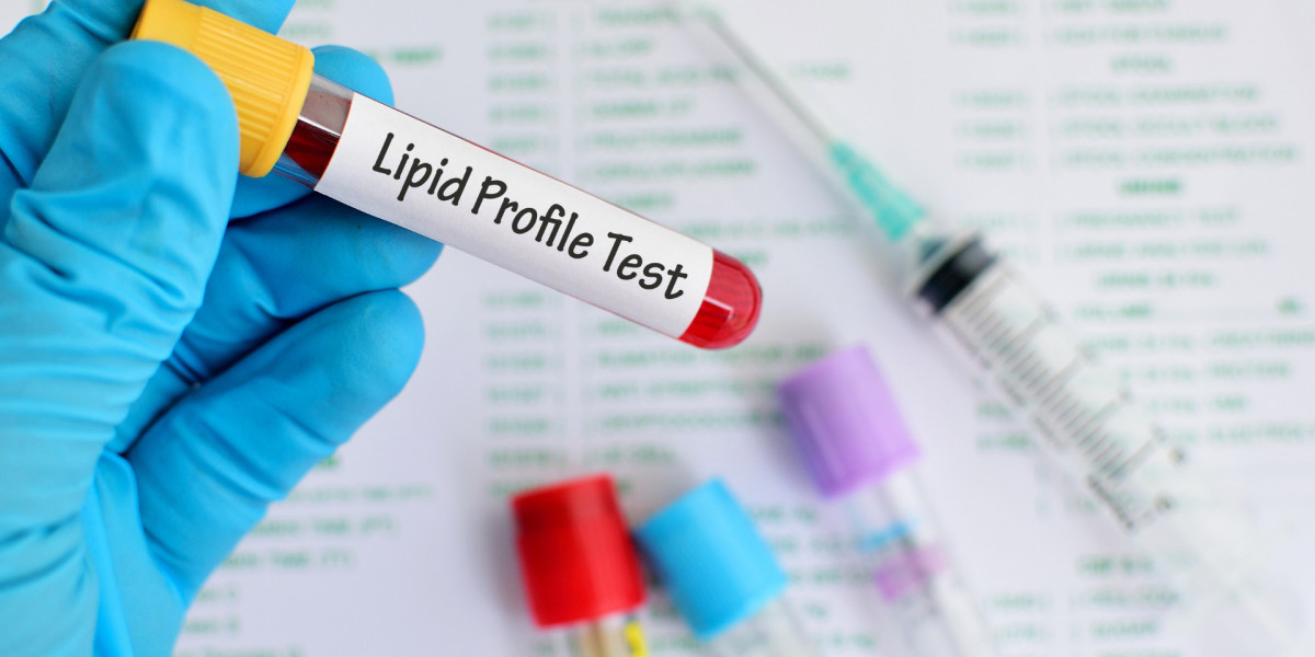 Europe Lipid Market Thrives Amid Rising Health Awareness and Demand for Nutraceuticals – Renub Research
