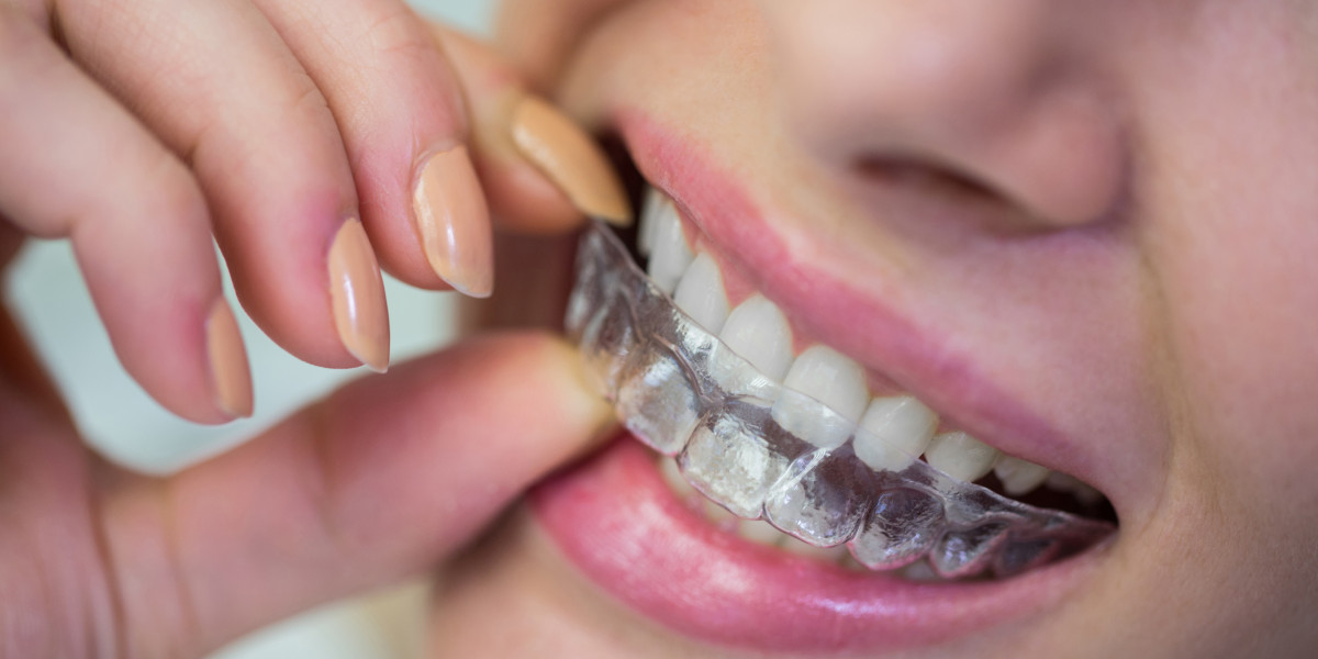Invisalign Beugel: De Moderne Oplossing voor Rechte Tanden
