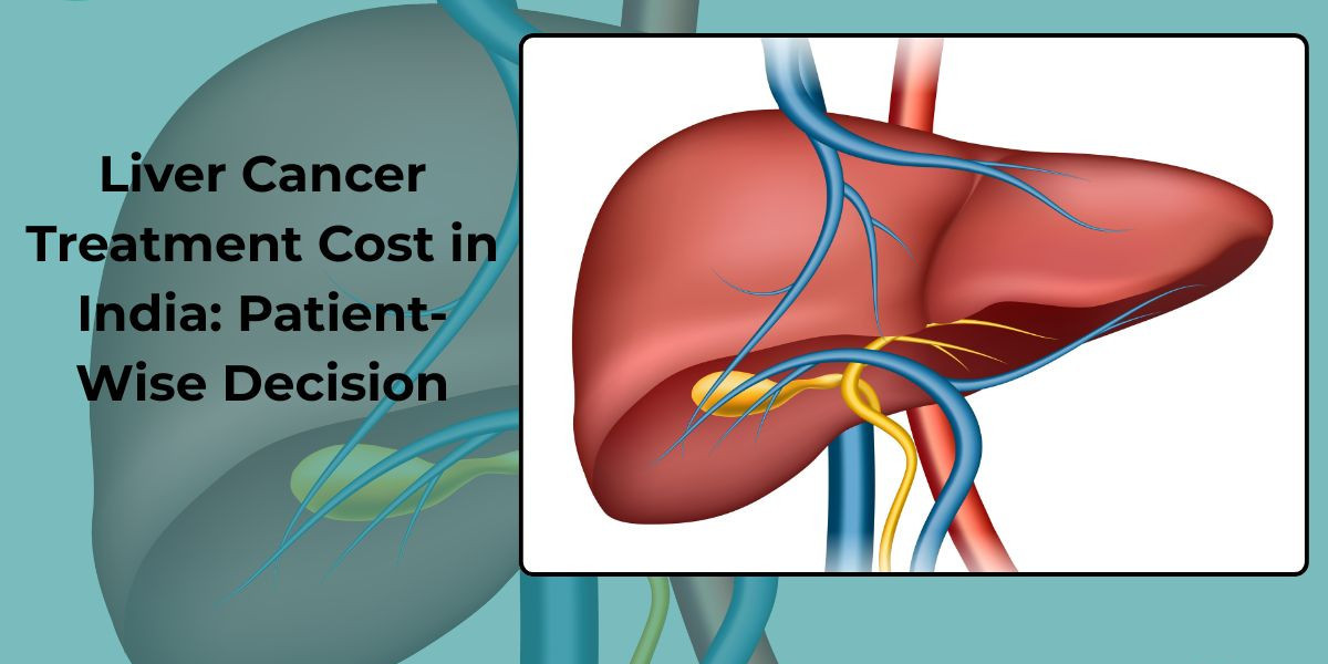 Liver Cancer Treatment Cost in India: Patient-Wise Decision