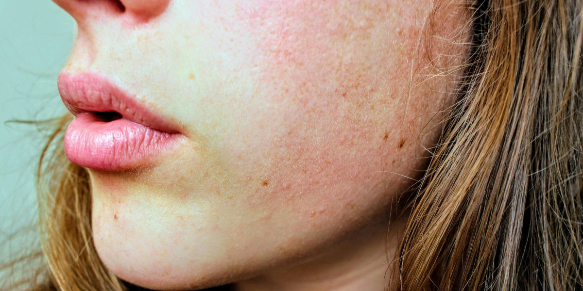 The Ultimate Guide to Soothing Dry & Itchy Skin