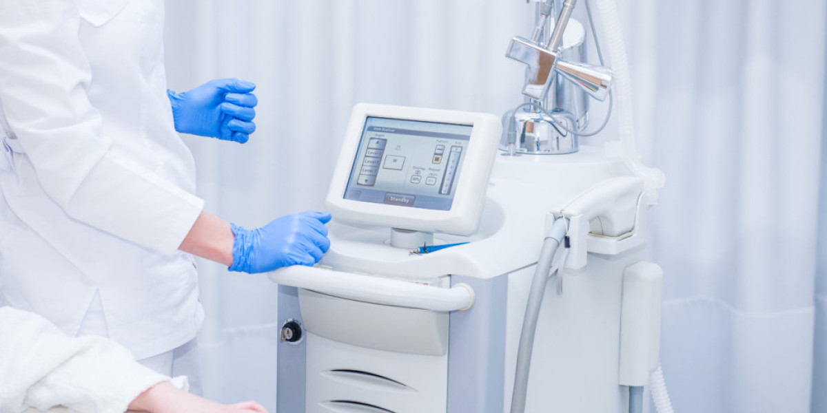 Laser Marks Removal with Mart Laser – Precision Cleaning for a Flawless Finish