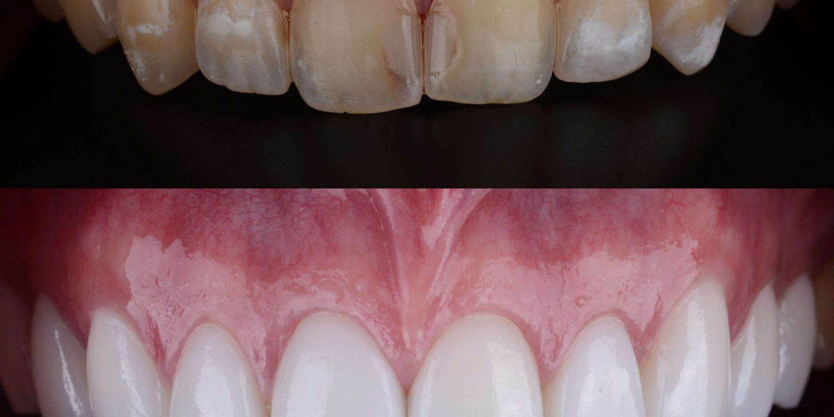 Oral Health and Beyond: The Link to Overall Wellbeing