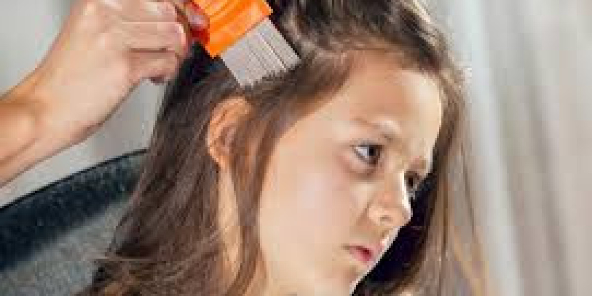 Lice Treatment for Long Hair: Tips and Tricks