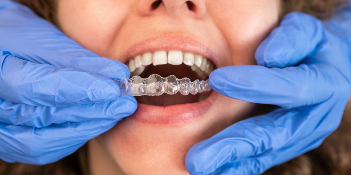 Straighten Your Smile with Invisalign & Top Dentist in Wokingham
