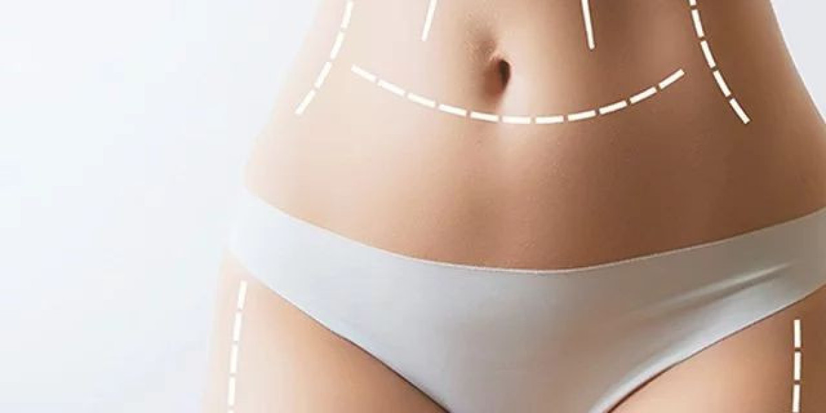 Body Sculpting Procedure for Achieving a More Toned Figure