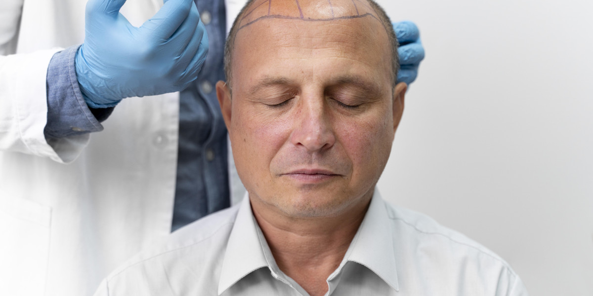 Hair Transplant in Dubai — Your 2025 Guide to Restoration, Costs, and Choosing the Right Clinic