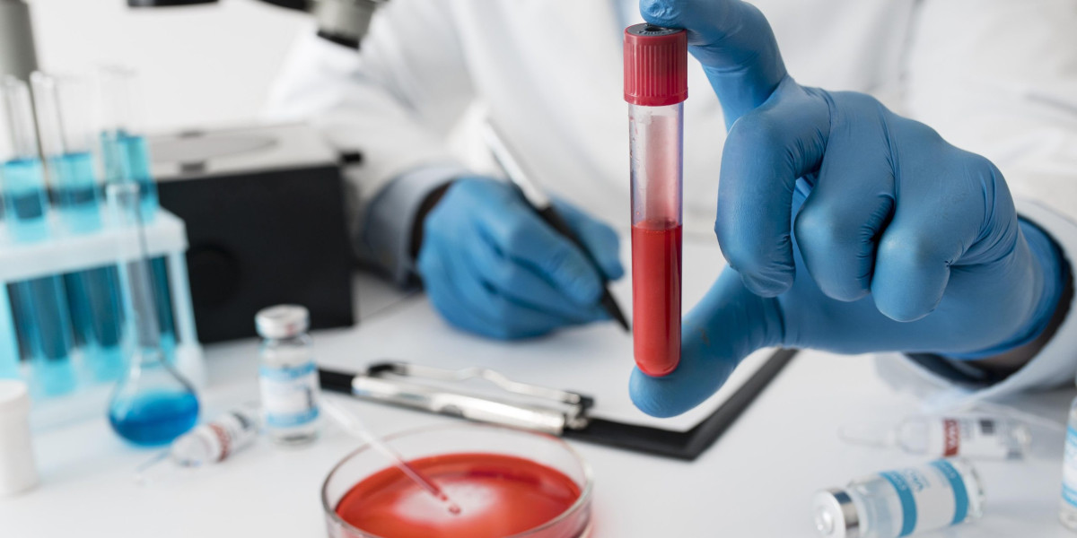 Blood Test at Home Bangalore: Convenient Health Monitoring with Ecotown