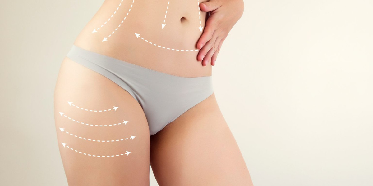 Liposuction vs Non-Surgical Fat Removal: Which is Better for You?