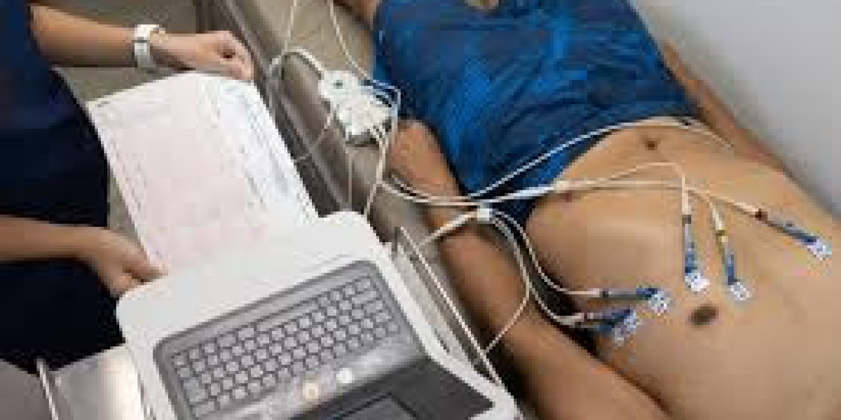 ECG Scan Near Me – A Complete Guide by Ecotown