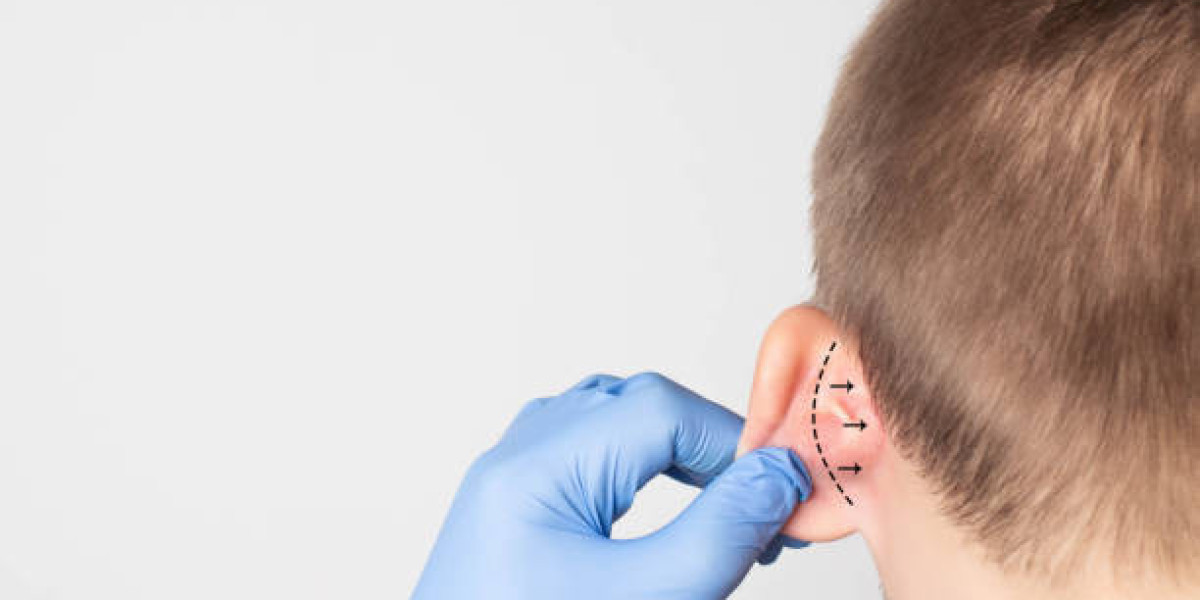 Discover Ear Reshaping in Dubai for Harmonious Facial Features