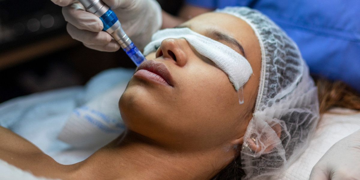 Why Laser Hair Removal Treatment Is the Best Choice