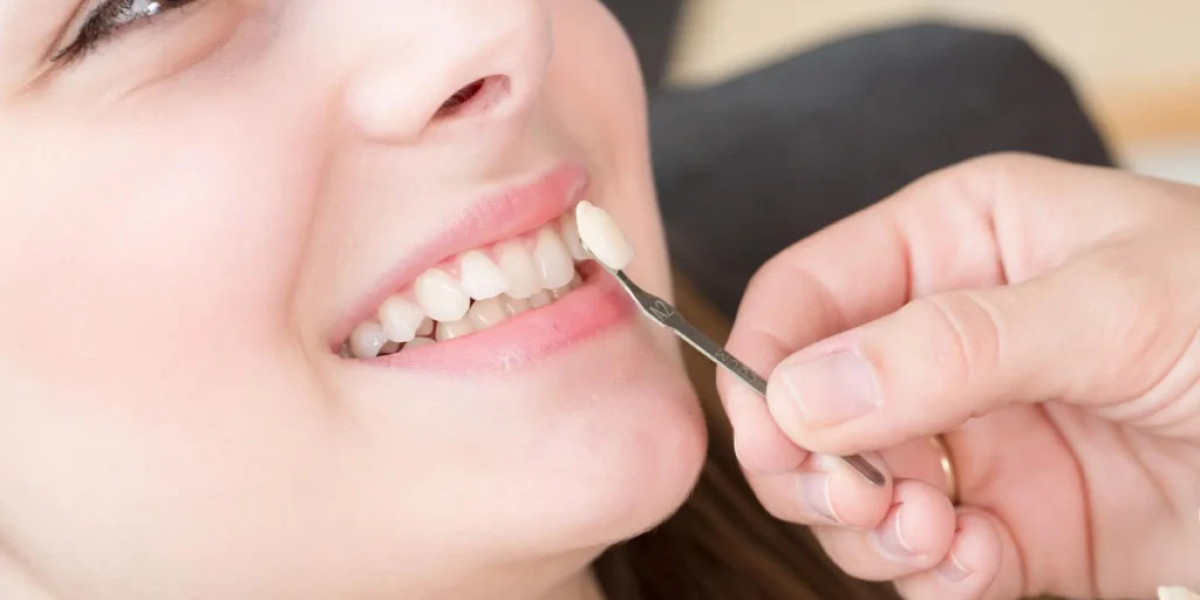 What Cosmetic Dental Care Can Do For Long-term Oral Health
