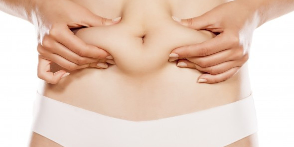 Why Liposuction in Islamabad Is Gaining Popularity