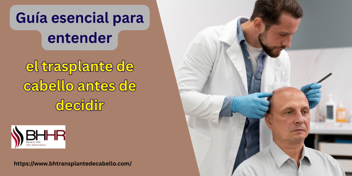 Guía esencial para entender el transplante de cabello antes de decidir
