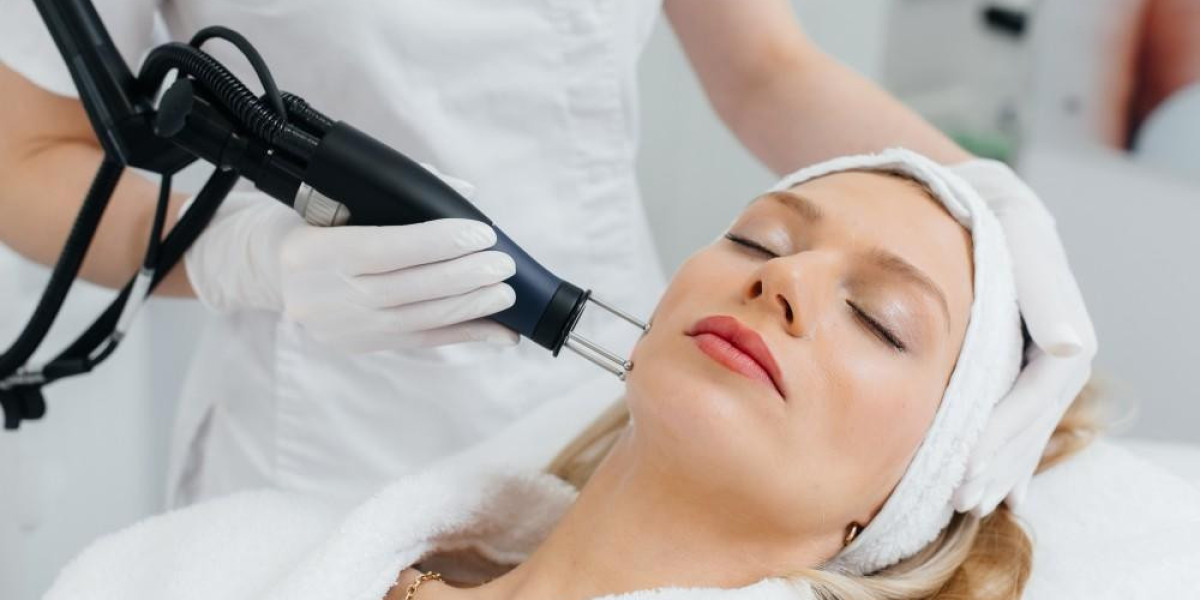 What Skin Imperfections Can Laser Treatments Target Effectively?