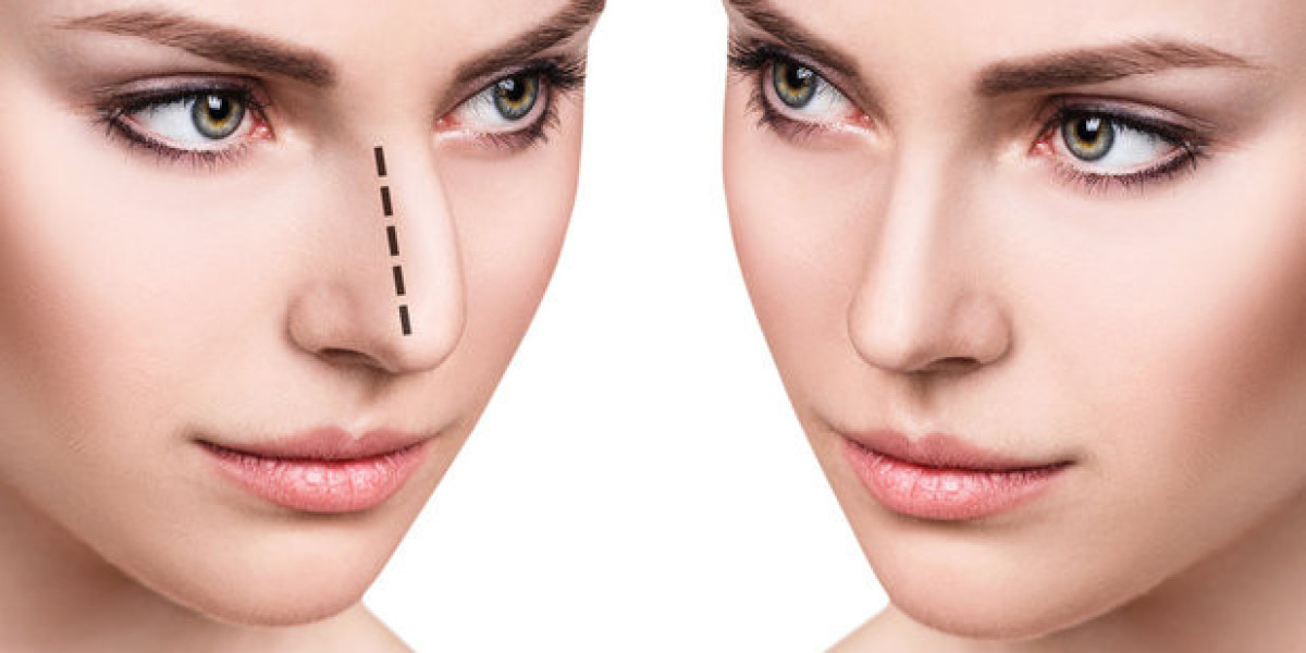 10 نصائح قبل إجراء عملية تجميل الأنف في الرياض