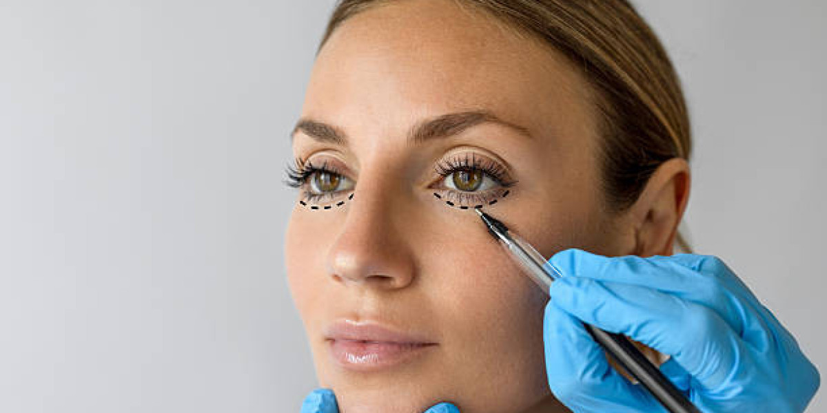 Eyelid Surgery: Techniques and Innovations in Modern Ophthalmic Care