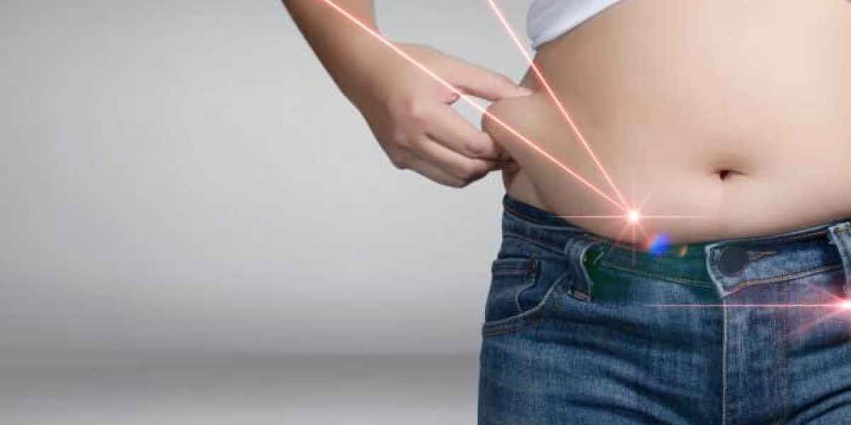 What Benefits Come with Liposuction in Dubai?