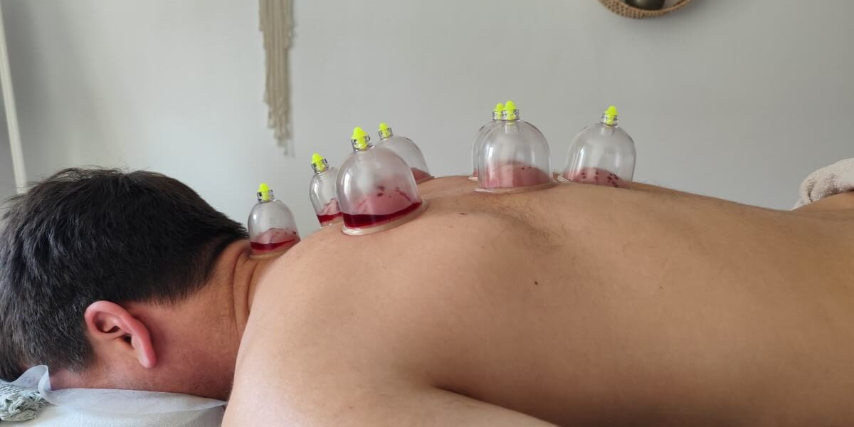 Hijama Treatment Cost for Shoulder and Back Therapy