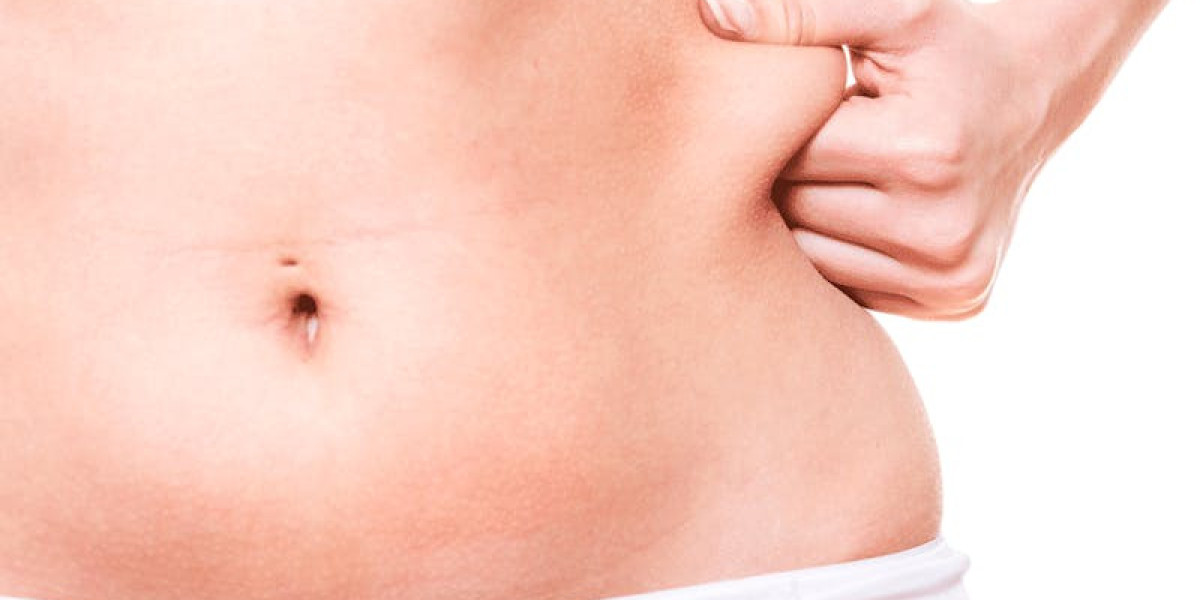 How Liposuction Shapes the Waistline