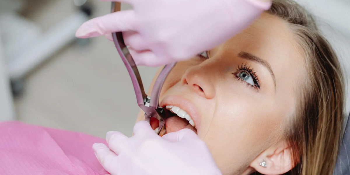 Tooth Extraction Treatment and Oral Hygiene: Best Practices Post-Procedure