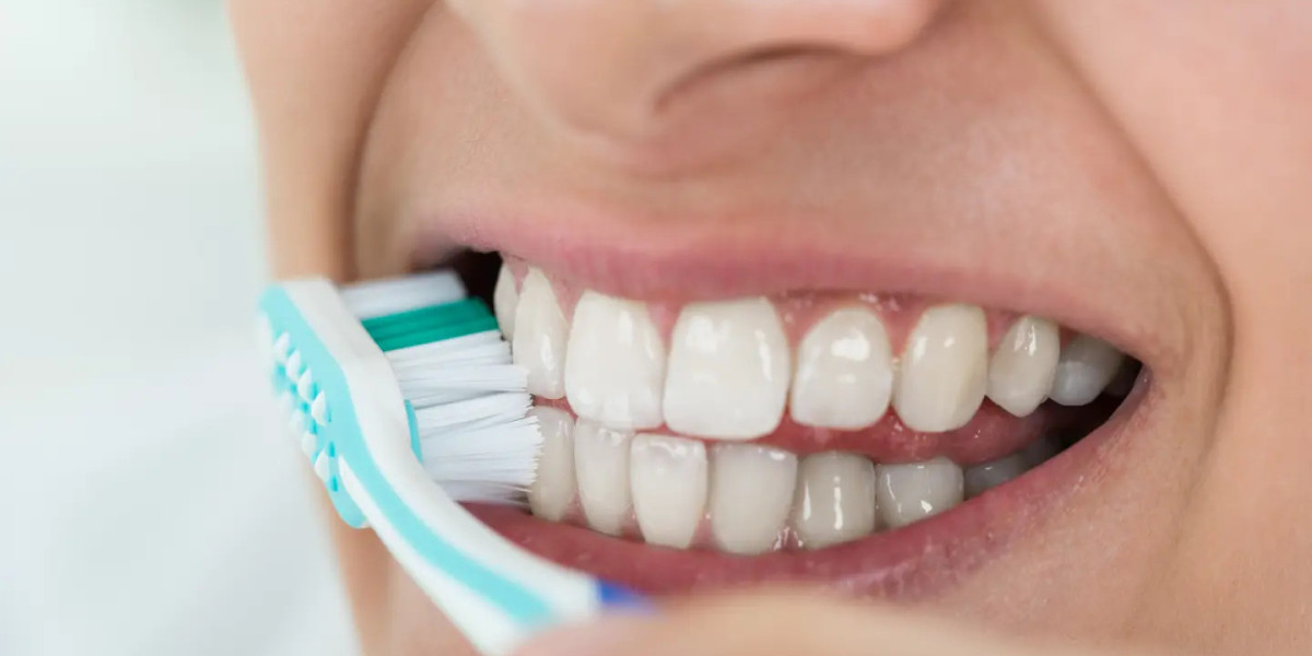 Teeth Cleaning: What to Expect Before and After