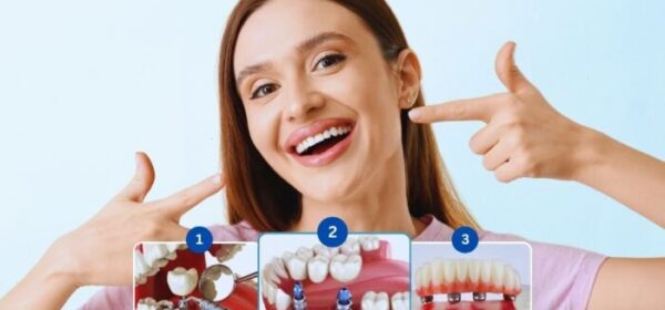 Dental Implants Vancouver BC | Oakridge Family Dental