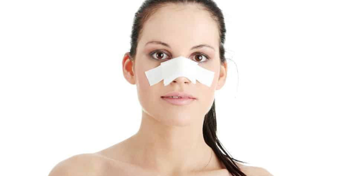 Alarplasty: Pros and Cons You Should Know