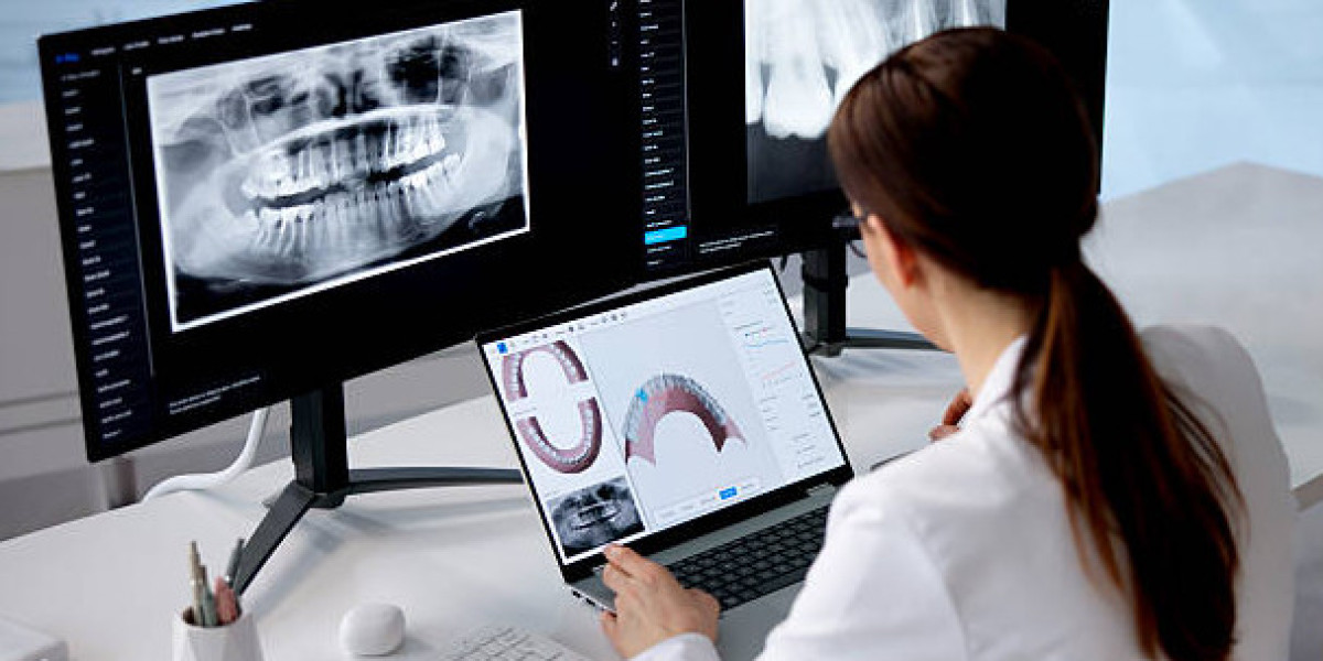 Full Mouth Dental Implants Turkey Package Deals A Complete UK Guide to Total Smile Transformation