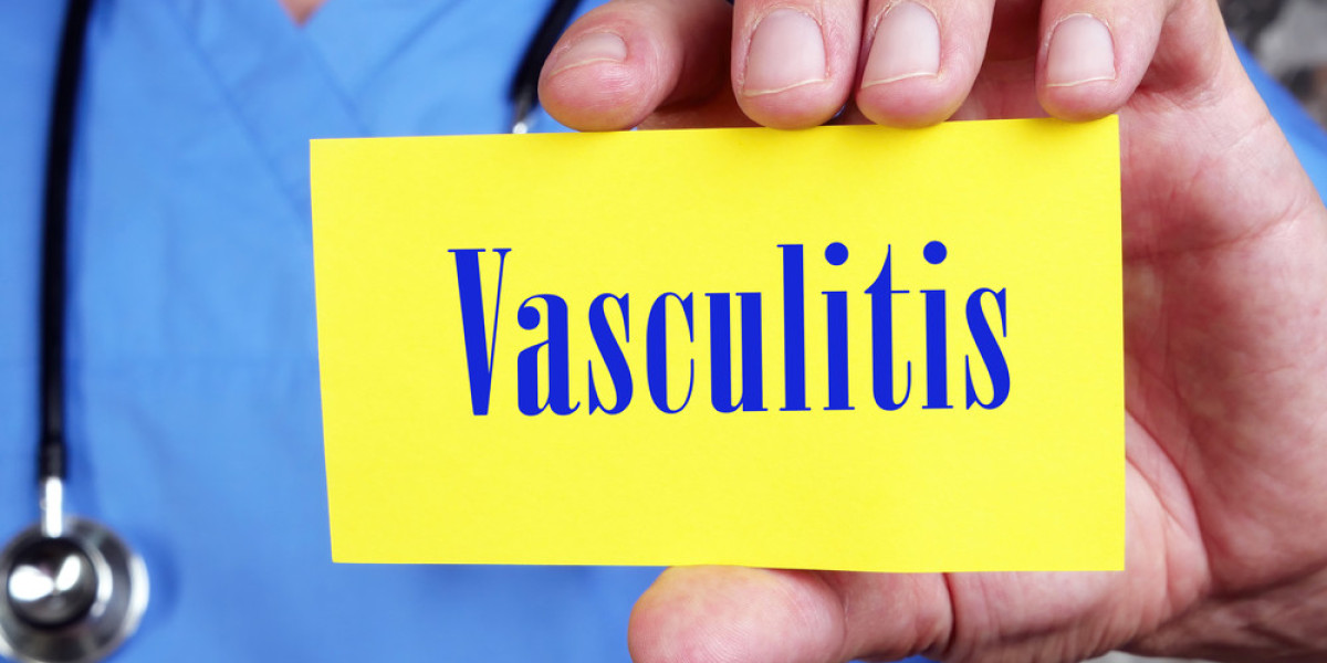 ANCA Vasculitis vs. Lupus: Understanding Two Autoimmune Diseases With Similar Signs