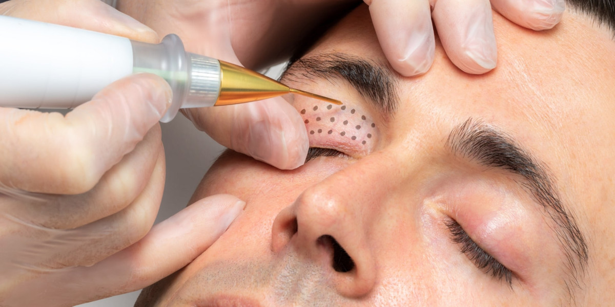 Why Try Plasma Pen Treatment Dubai for Wrinkles