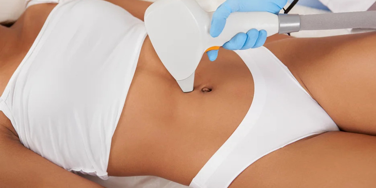 Laser Hair Removal for Stomach Hair: Is It Effective?
