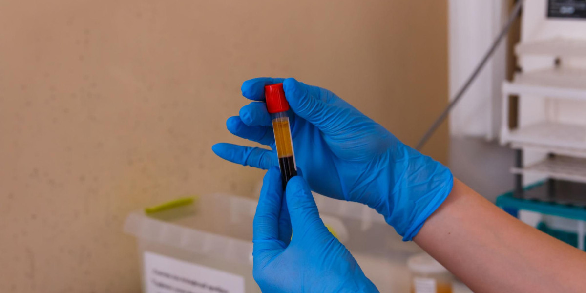 Best Pathology Lab for Full Body Checkup in Greater Noida: How to Choose the Right One