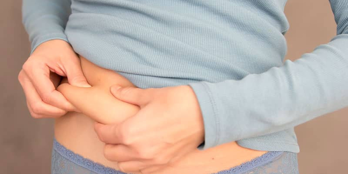 Liposuction in Dubai: Your Path to a Contoured Figure