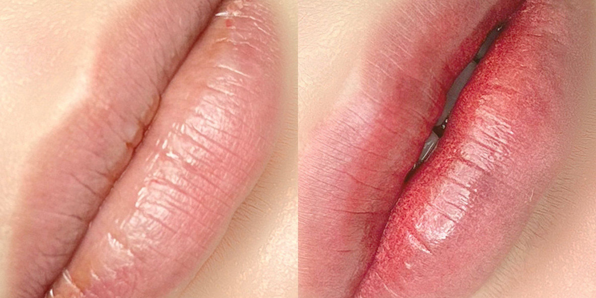 Does Russian Lip Filler sculpt lips into elegant shape instantly?