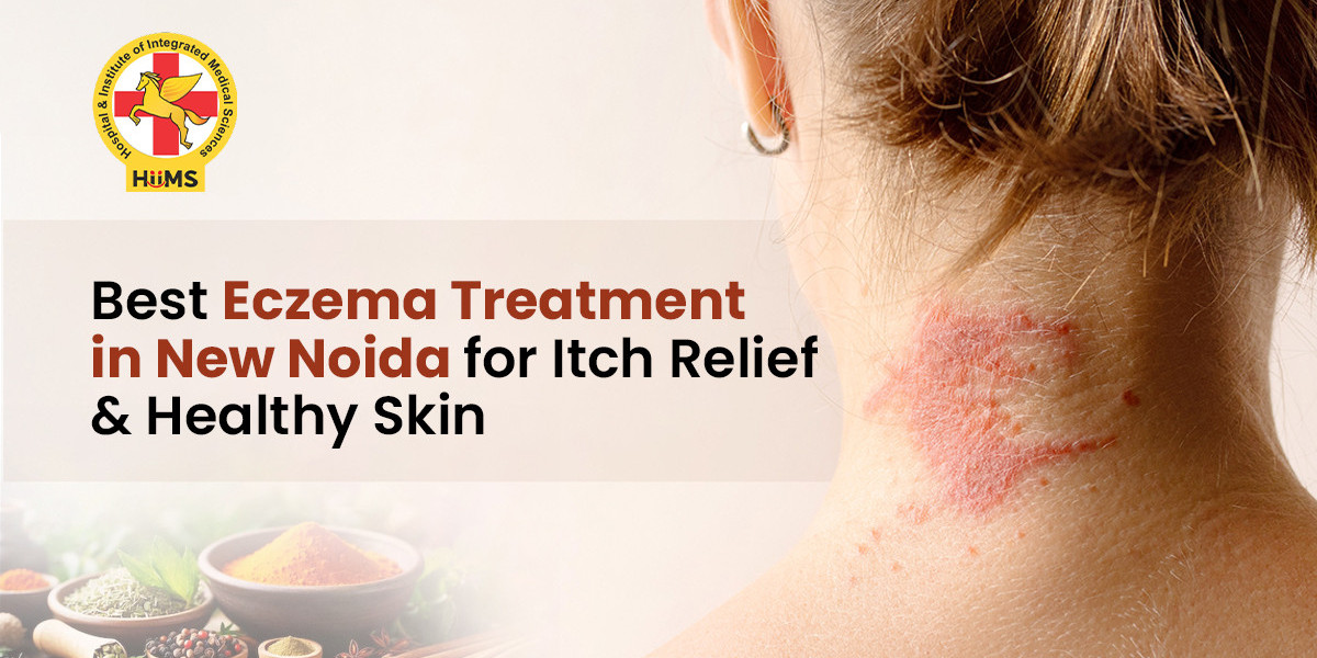 Expert Eczema Treatment for Healthy Skin and Better Comfort