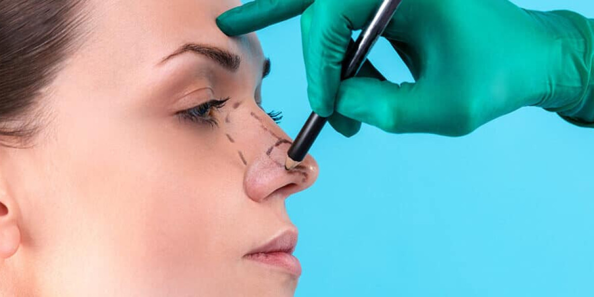 5 Common Nose Shape Issues Rhinoplasty Can Fix
