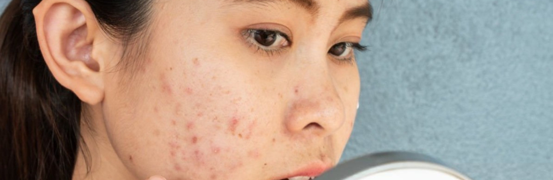 Nehayadavdermatologist Cover Image