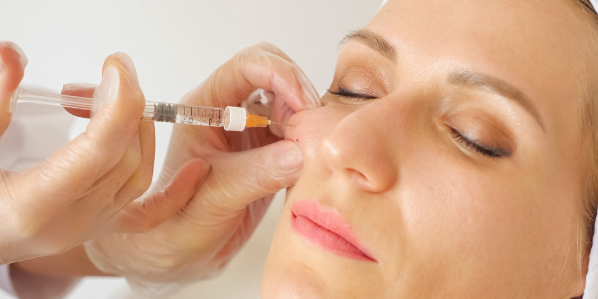 Sculptra Fillers do they enhance soft volume facial definition?