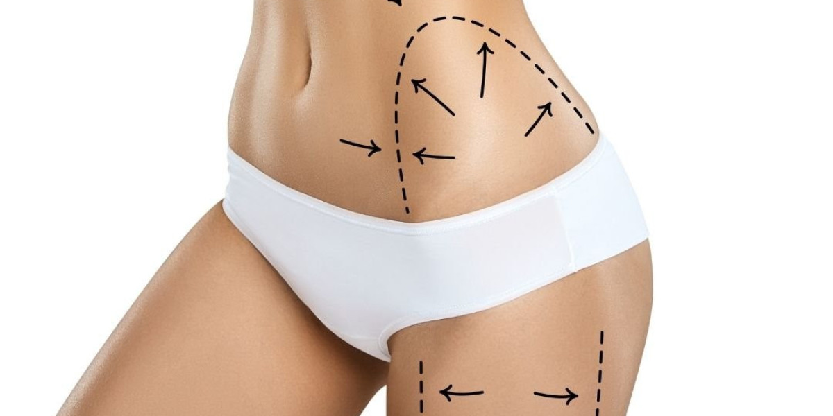 Fat Transfer Surgery for Scar Treatment: A Detailed Guide