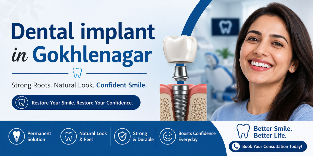 Best Solutions for Dental Implant in Kothrud and Dental Implant in Gokhlenagar