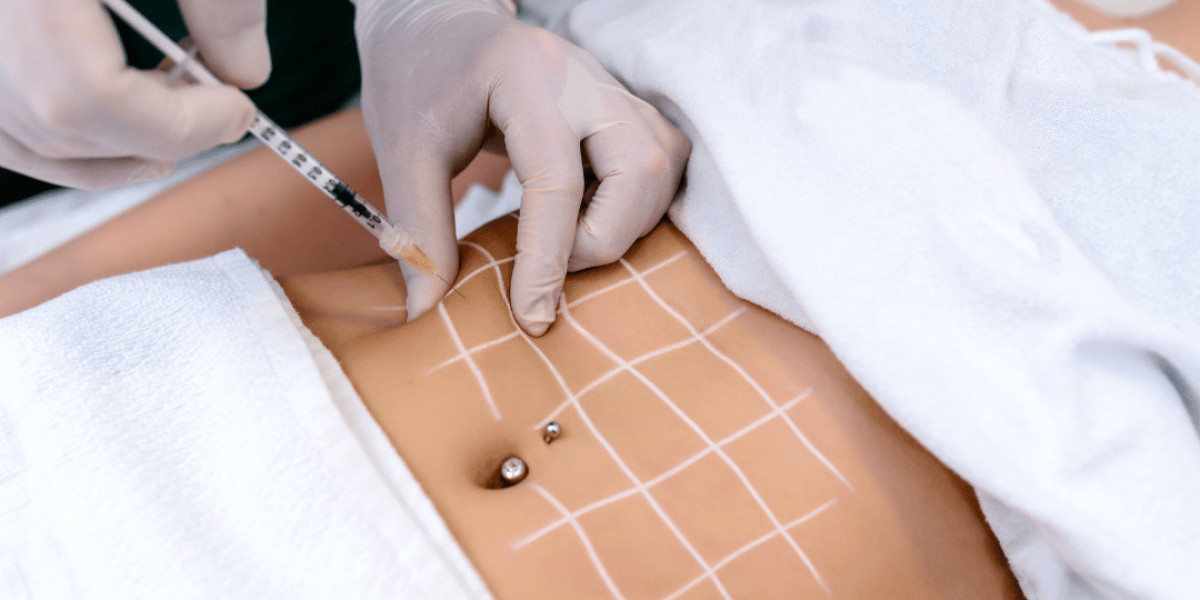Are Body Fillers the Body Trend for a Smooth, Toned, and Refreshed Belly Look?
