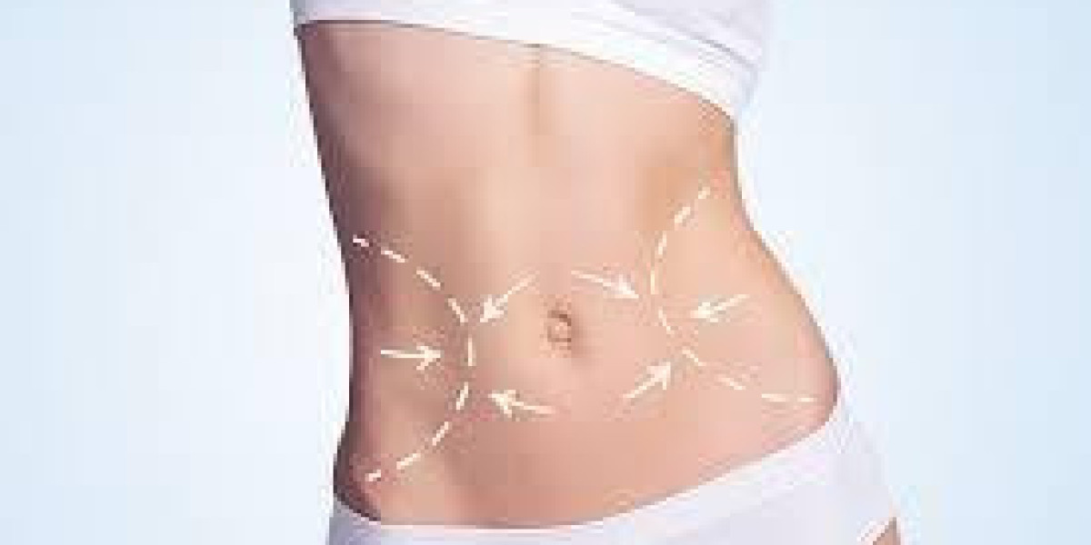 Can Bariatric Surgery in Islamabad Help Control Appetite?