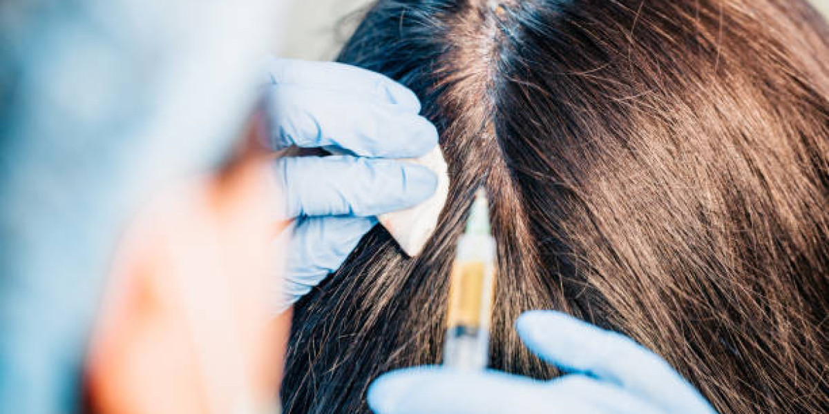 Exosome Hair in Dubai: Integrating Lifestyle for Lasting Results