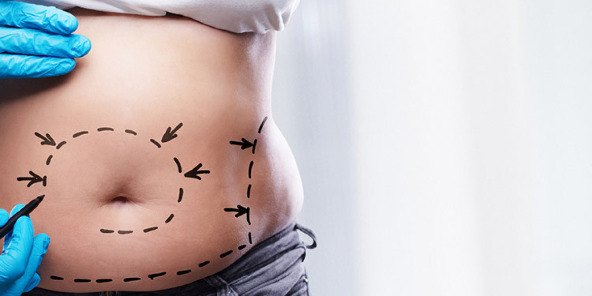 Managing Recovery & Minimizing Side Effects After Your Mommy Makeover Dubai